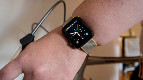 Illustration for article titled The Apple Watch No Longer Totally Sucks